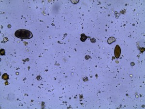 mauve's faecal under microscope